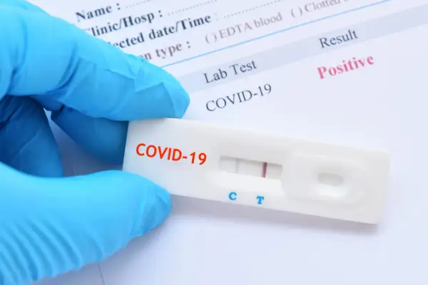Ręka w niebieskiej rękawiczce trzyma test antygenowy COVID-19 z dwoma widocznymi paskami, wskazującymi na pozytywny wynik.