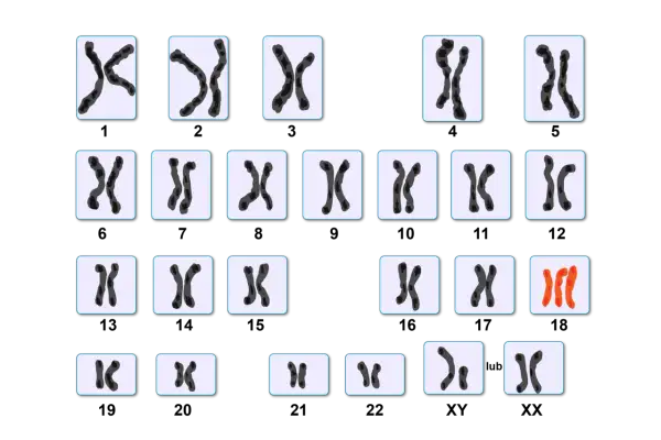 Kariotyp przedstawia pary chromosomów, w tym wyróżniające się czerwone chromosomy.