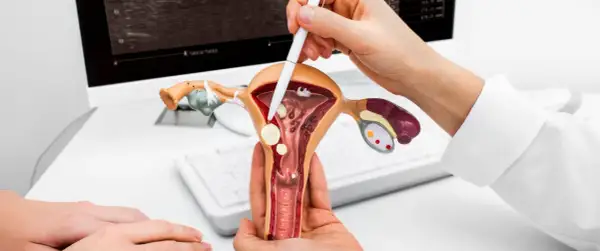 Model macicy z widocznymi mięśniakami. Lekarz wskazuje na nie, omawiając diagnozę.
